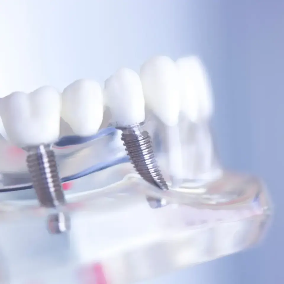 bodrum çoklu implant