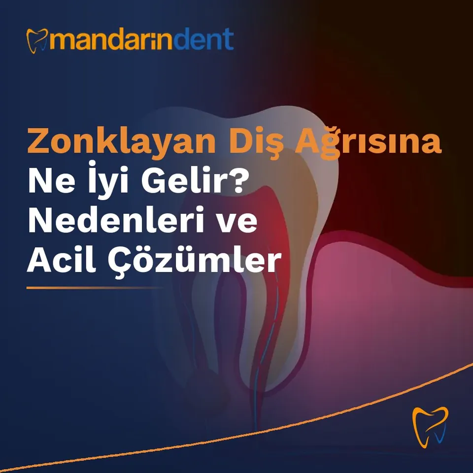 Zonklayan Diş Ağrısına Ne İyi Gelir? Nedenleri ve Acil Çözümler