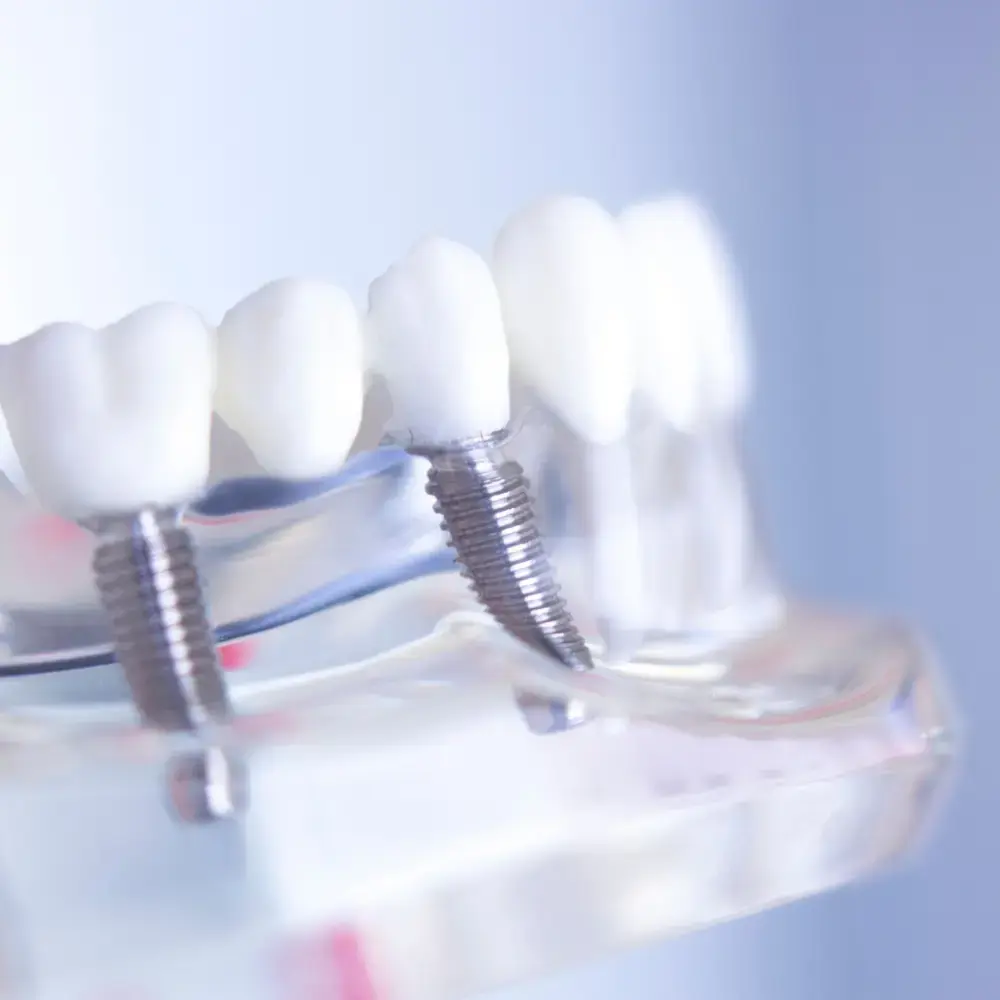 bodrum çoklu implant