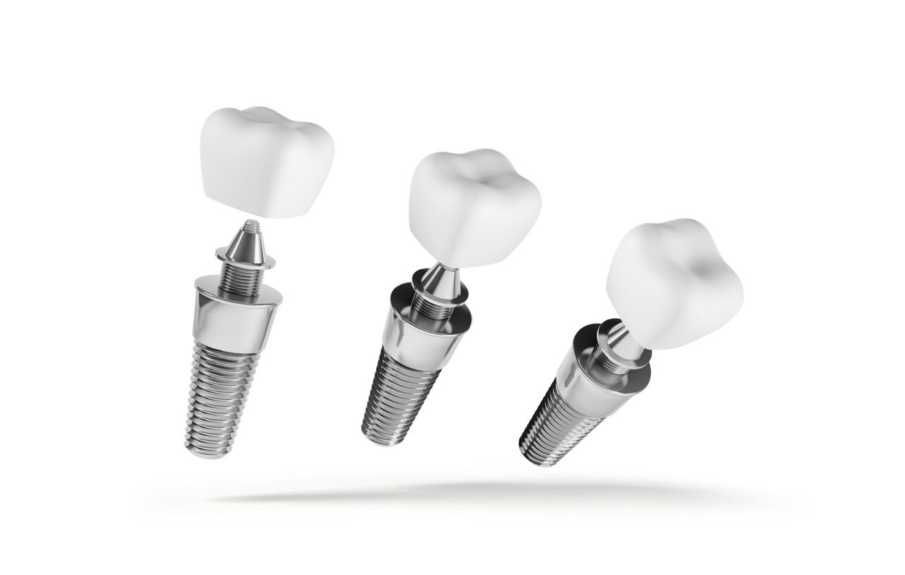 Bodrum’da çoklu diş implantı ile eksik dişlerinizi tamamlayın. Mandarin Dent uzmanlarıyla sağlıklı, estetik ve güçlü çiğneme fonksiyonuna sahip dişlere kavuşun!