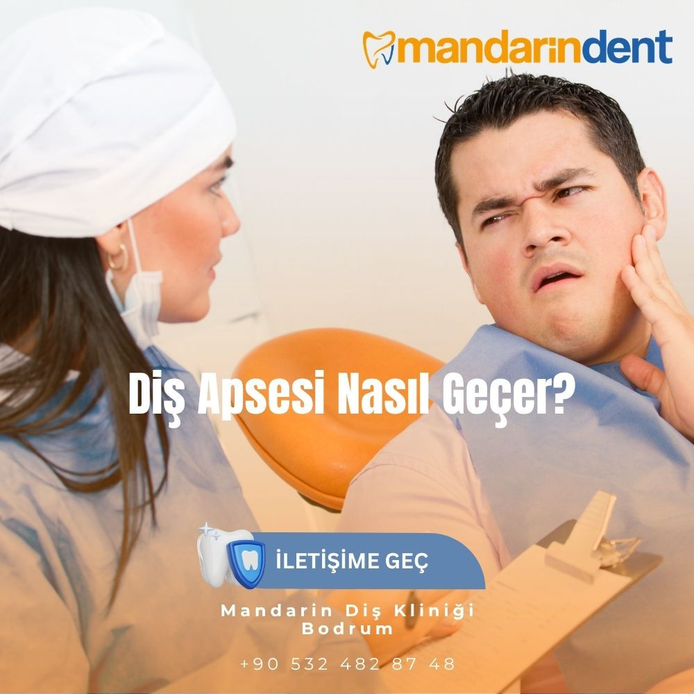Diş Apsesi Nasıl Geçer? | Belirtiler, Acil Eşik ve Hekim Değerlendirmesi