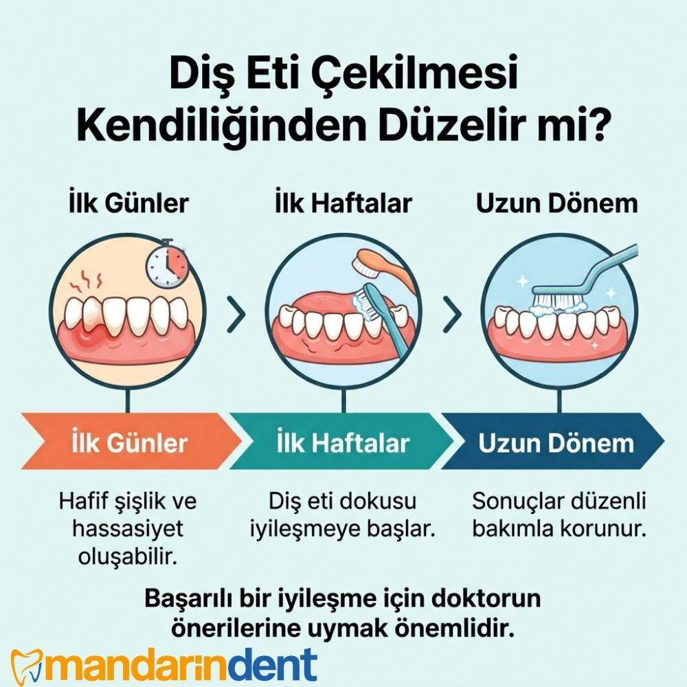 Diş eti çekilmesi geri düzelir mi