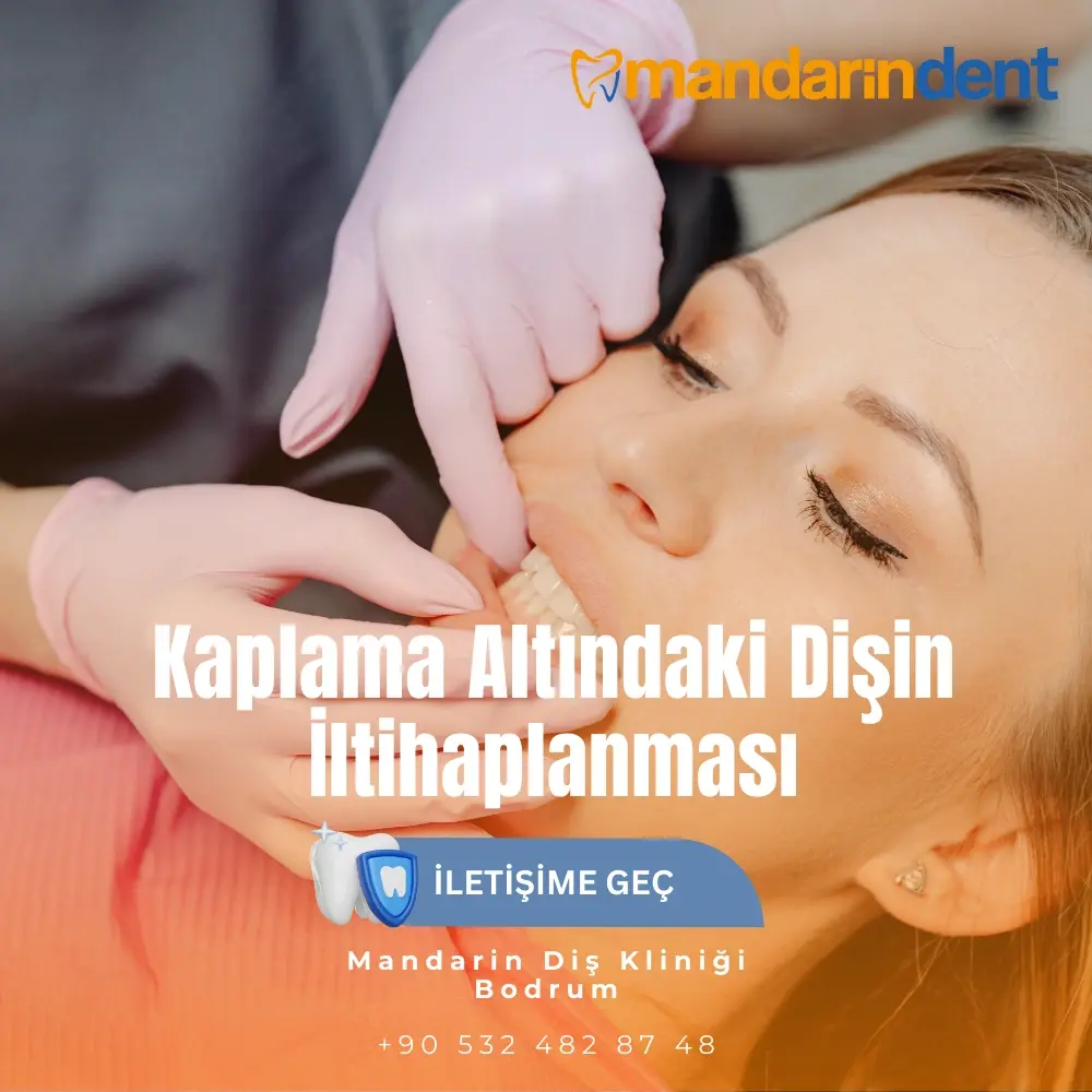 Kaplama Altındaki Dişin İltihaplanması