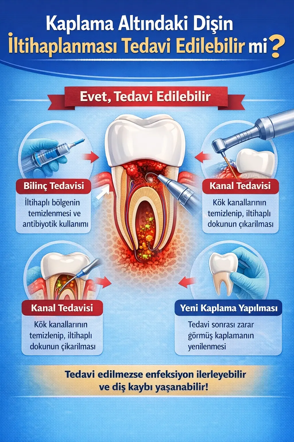 kaplama altındaki dişin iltihaplanması kadınlar kulübü