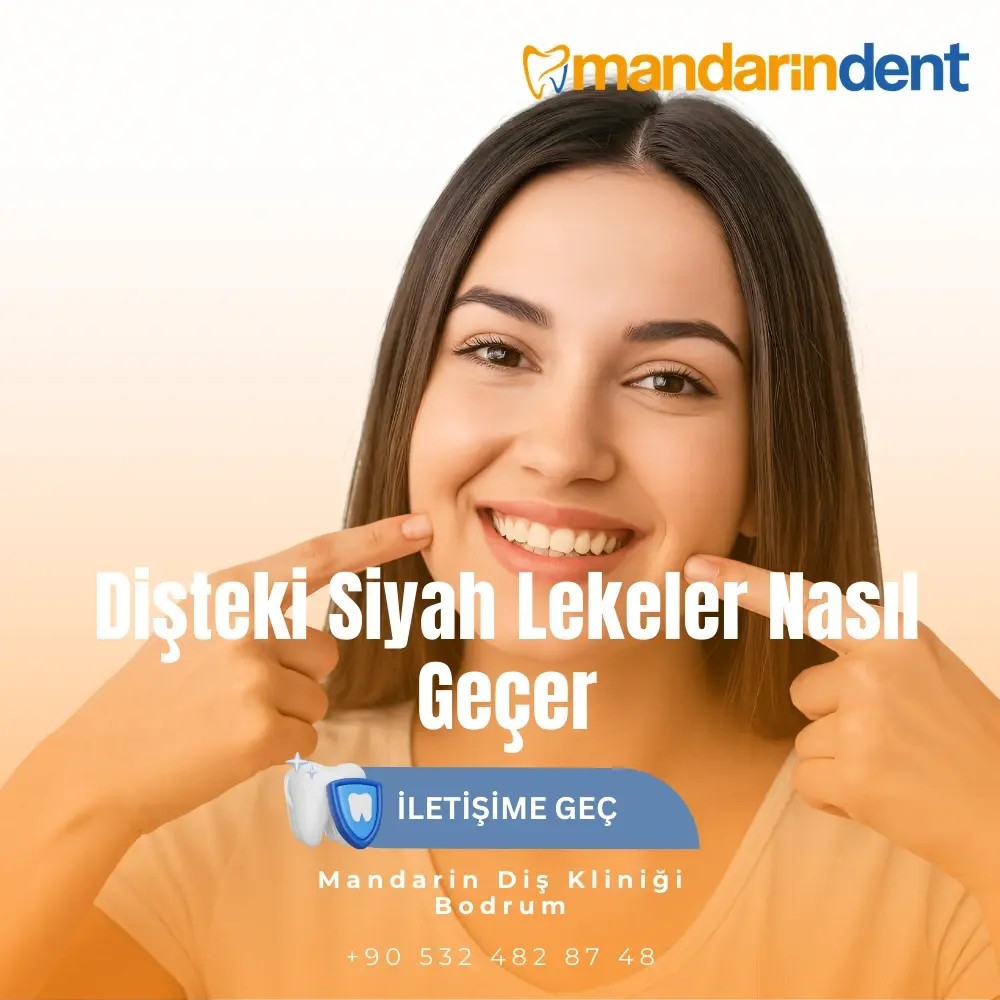Dişteki Siyah Lekeler Nasıl Geçer